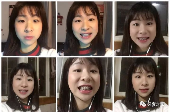 整完变好看多了